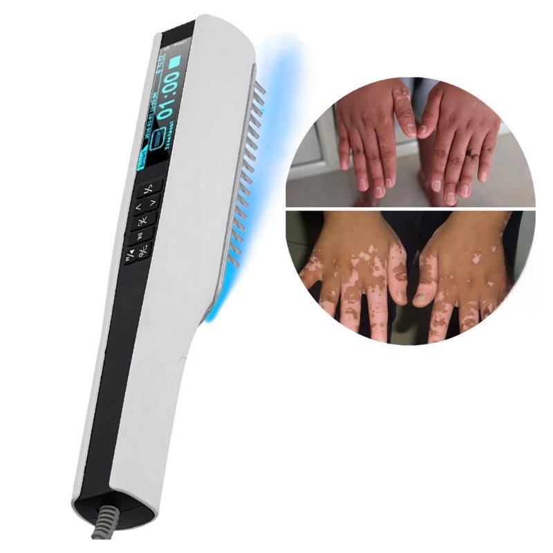 আল্ট্রাভায়োলেট ফটোথেরাপি ডিভাইস